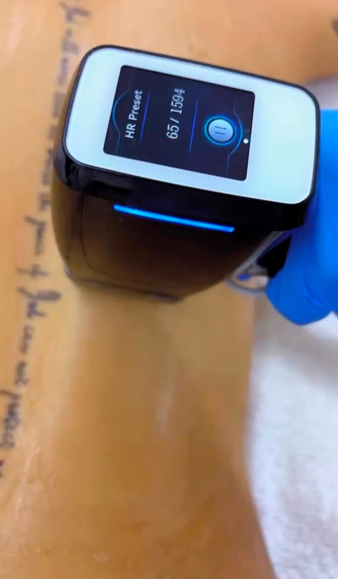 Modern laserutrustning – handenhet i klinikmiljö